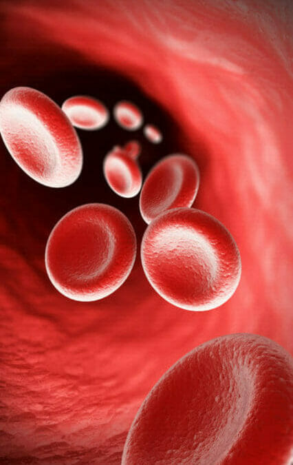 Iron Deficiency Anemia