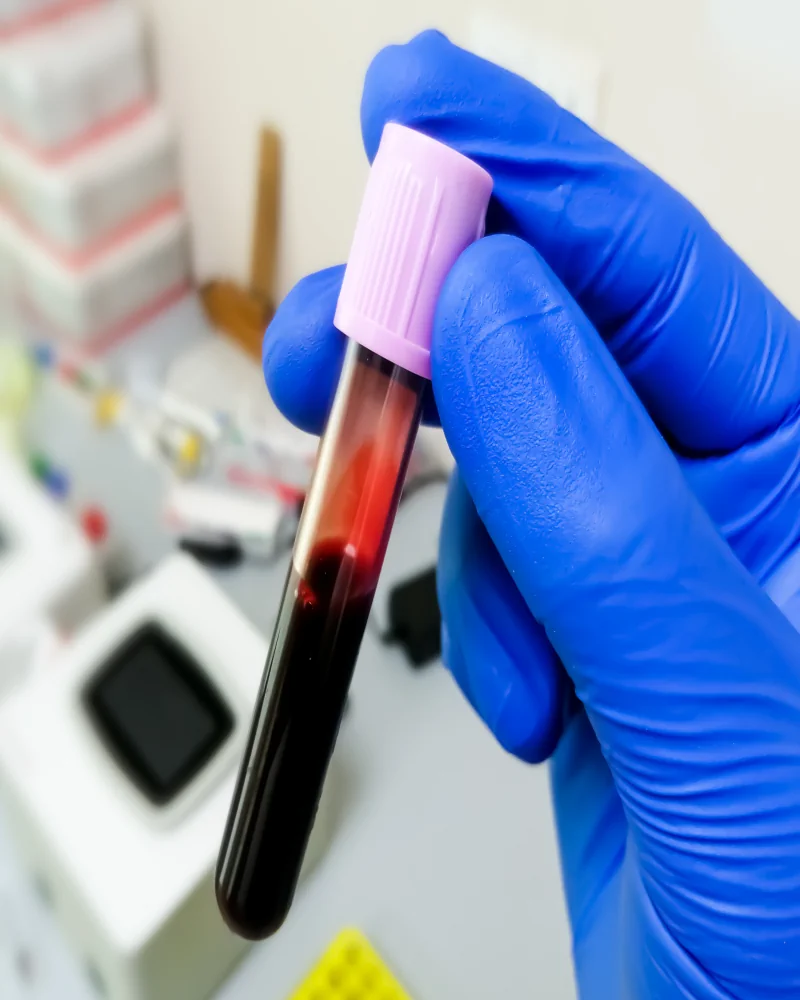 Blood sample collected for Integrated Primary Care for Addiction Treatment, Sarasota FL Blood sample collected for Integrated Primary Care for Addiction Treatment, Sarasota FL